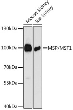 ABclonal Technology&nbsp;MSP/MST1 Rabbit pAb