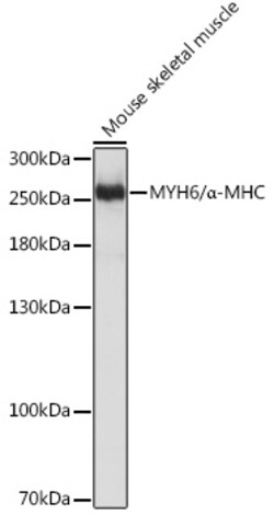 ABclonal Technology&nbsp;MYH6/α-MHC Rabbit pAb