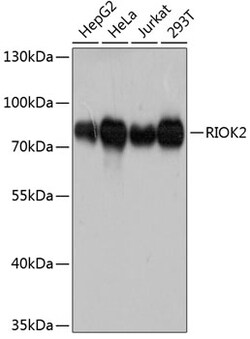 ABclonal Technology&nbsp;RIOK2 Rabbit pAb