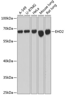 ABclonal Technology&nbsp;EHD2 Rabbit pAb