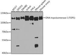 ABclonal Technology&nbsp;DNA topoisomerase I (TOP1) Rabbit pAb
