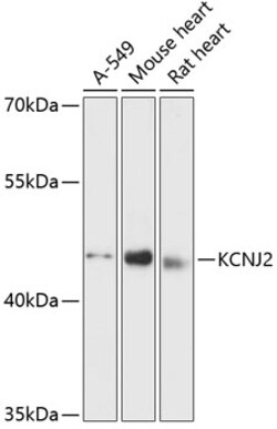 ABclonal Technology&nbsp;KCNJ2 Rabbit pAb