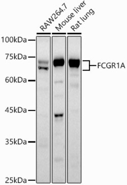 ABclonal Technology&nbsp;CD64 Rabbit pAb