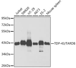 ABclonal Technology&nbsp;TDP-43/TARDBP Rabbit pAb