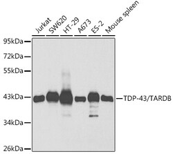 ABclonal Technology&nbsp;TDP-43/TARDBP Rabbit pAb