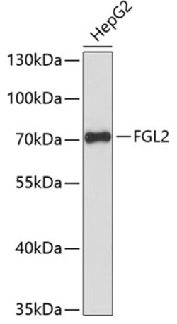 ABclonal Technology&nbsp;FGL2 Rabbit pAb