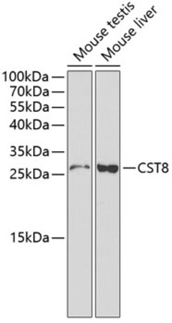 ABclonal Technology&nbsp;CST8 Rabbit pAb