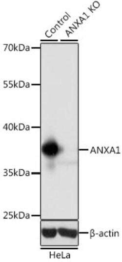 ABclonal Technology&nbsp;[KO Validated] ANXA1 Rabbit pAb