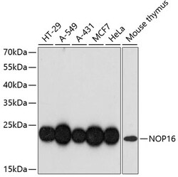 ABclonal Technology&nbsp;NOP16 Rabbit pAb