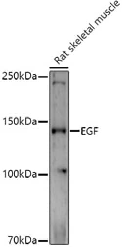 ABclonal Technology&nbsp;EGF Rabbit pAb