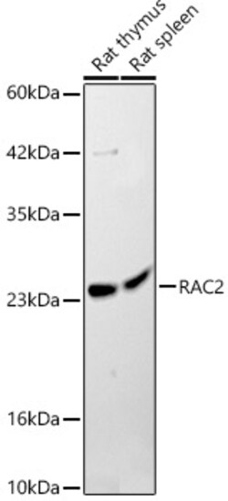 ABclonal Technology&nbsp;RAC2 Rabbit pAb