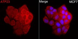 ABclonal Technology&nbsp;ATP23 Rabbit pAb