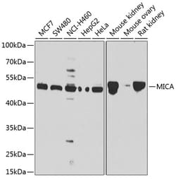 ABclonal Technology&nbsp;MICA Rabbit pAb