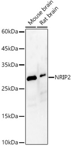 ABclonal Technology&nbsp;NRIP2 Rabbit pAb