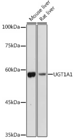 ABclonal Technology&nbsp;UGT1A1 Rabbit pAb