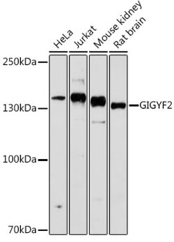 ABclonal Technology&nbsp;GIGYF2 Rabbit pAb