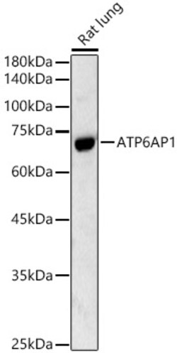 ABclonal Technology&nbsp;ATP6AP1 Rabbit pAb