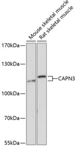 ABclonal Technology&nbsp;CAPN3 Rabbit pAb