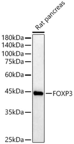 ABclonal Technology&nbsp;FOXP3 Rabbit pAb