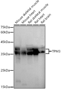 ABclonal Technology&nbsp;TPM3 Rabbit pAb