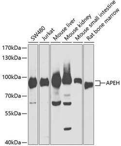 ABclonal Technology&nbsp;APEH Rabbit pAb