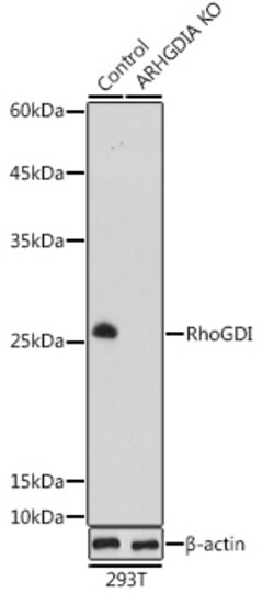 ABclonal Technology&nbsp;[KO Validated] RhoGDI Rabbit pAb