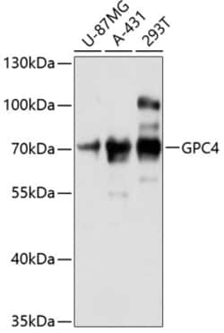 ABclonal Technology&nbsp;GPC4 Rabbit pAb