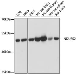ABclonal Technology&nbsp;[KO Validated] NDUFS2 Rabbit pAb