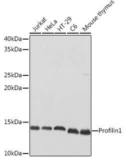ABclonal Technology&nbsp;Profilin1 Rabbit pAb