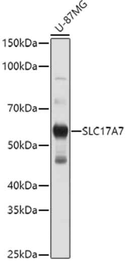 ABclonal Technology&nbsp;SLC17A7 Rabbit pAb