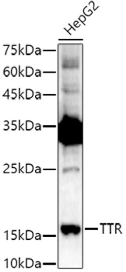 ABclonal Technology&nbsp;TTR Rabbit pAb