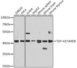 ABclonal Technology&nbsp;TDP-43/TARDBP Rabbit pAb