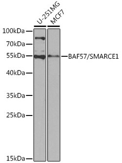 ABclonal Technology&nbsp;[KO Validated] BAF57/SMARCE1 Rabbit pAb
