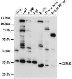 ABclonal Technology&nbsp;OSTM1 Rabbit pAb