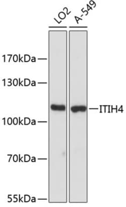 ABclonal Technology&nbsp;ITIH4 Rabbit pAb