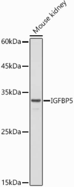 ABclonal Technology&nbsp;IGFBP5 Rabbit pAb
