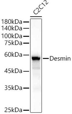 ABclonal Technology&nbsp;Desmin Rabbit pAb