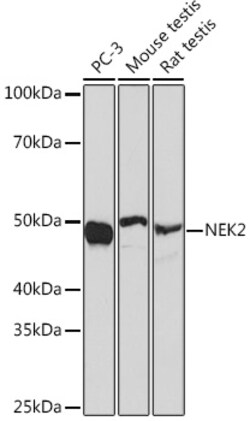 ABclonal Technology&nbsp;NEK2 Rabbit mAb