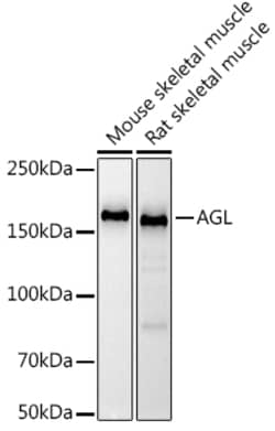 ABclonal Technology&nbsp;AGL Rabbit mAb
