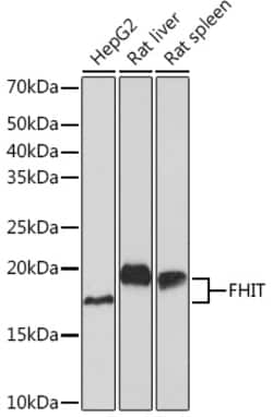 ABclonal Technology&nbsp;FHIT Rabbit mAb