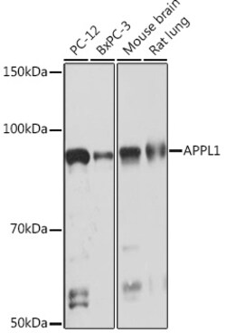 ABclonal Technology&nbsp;APPL1 Rabbit mAb