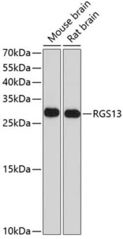 ABclonal Technology&nbsp;RGS13 Rabbit pAb