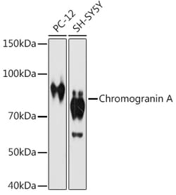 ABclonal Technology&nbsp;Chromogranin A Rabbit mAb