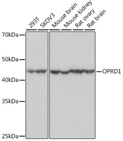 ABclonal Technology&nbsp;OPRD1 Rabbit mAb