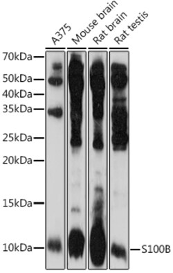 ABclonal Technology&nbsp;S100B Rabbit pAb