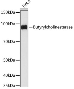 ABclonal Technology&nbsp;Butyrylcholinesterase Rabbit mAb