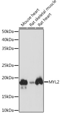 ABclonal Technology&nbsp;MYL2 Rabbit mAb