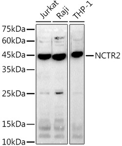 ABclonal Technology&nbsp;NCTR2 Rabbit mAb