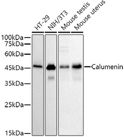 ABclonal Technology&nbsp;Calumenin Rabbit mAb