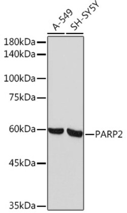 ABclonal Technology&nbsp;PARP2 Rabbit mAb